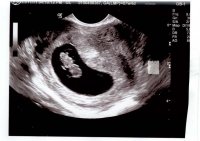 Baby at 7w4d pic 2.jpg