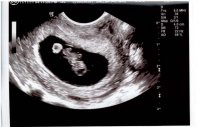 Baby at 7w4d pic 3.jpg