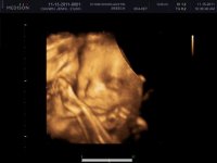 BABY CAGWIN_0004.jpg