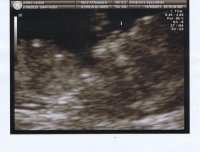 11.15_Baby1.jpg