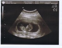 11.15_Baby2.jpg