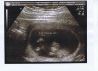 11.15_Baby3.jpg