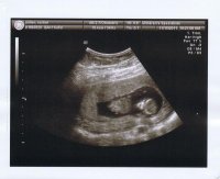 11.15_Baby4.jpg