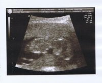 11.15_Baby5.jpg