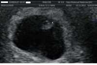 baby1.jpg