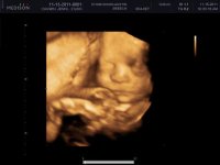 BABY CAGWIN_0010.jpg