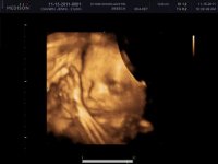BABY CAGWIN_0000.jpg