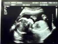 20 week + 6 days.JPG