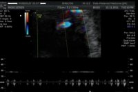 babyheart (1).jpg