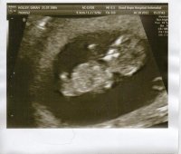 baby scan 11 weeks 3 days.jpg
