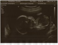 20weeks (3).jpg