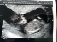 20111118_094715.jpg