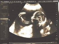 2nd Tri Scan (2).jpg