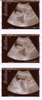 ultrasound_21nov2011.jpg