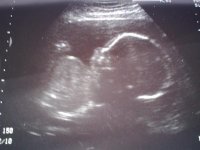 23112011357.jpg