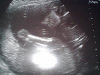 23112011355.jpg