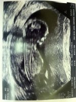 scan.jpg