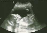 Wigglet 20wk scan cropped.jpg