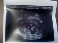 12 week scan.jpg