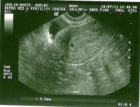 baby 001 (Small).jpg