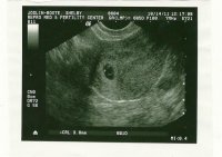 Gir 6w5d (Small).jpg