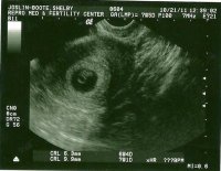 Gir 7w5d (Small).jpg