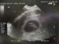 ultrasound 7w6d oct27.jpg