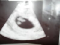 Ultrasound.jpg