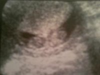baby 11 weeks.jpg