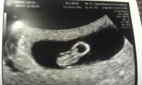 6wks5days.jpg