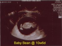 10w6d.JPG