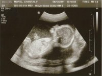 z-19weeks_0003.jpg