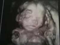 20 weeks.jpg