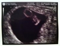 US Pic 12.8.11.jpg
