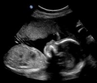 20 week scan 1.jpg