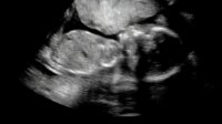 20 week scan full body.jpg