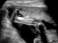 20 week scan leg.jpg