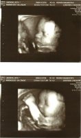 29weeks.jpg