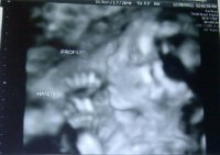 baby23w.jpg