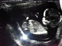 13weekscan.jpg