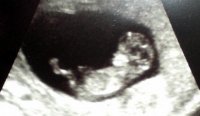 11 week scan.jpg