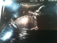 21 weeks scan.jpg
