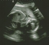 Wigglet 22+5wk scan1 cropped.jpg
