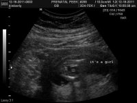 its a girl.jpg