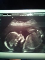 20 Week Scan.jpg