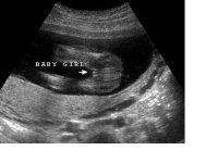 girl17weeks.jpg