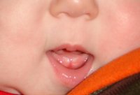 Two Teeth.jpg