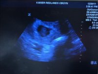 Baby.jpg