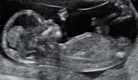 1 12W5D BABY PROFILE.jpg