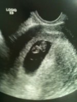 baby.JPG